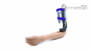 protesis-brazo